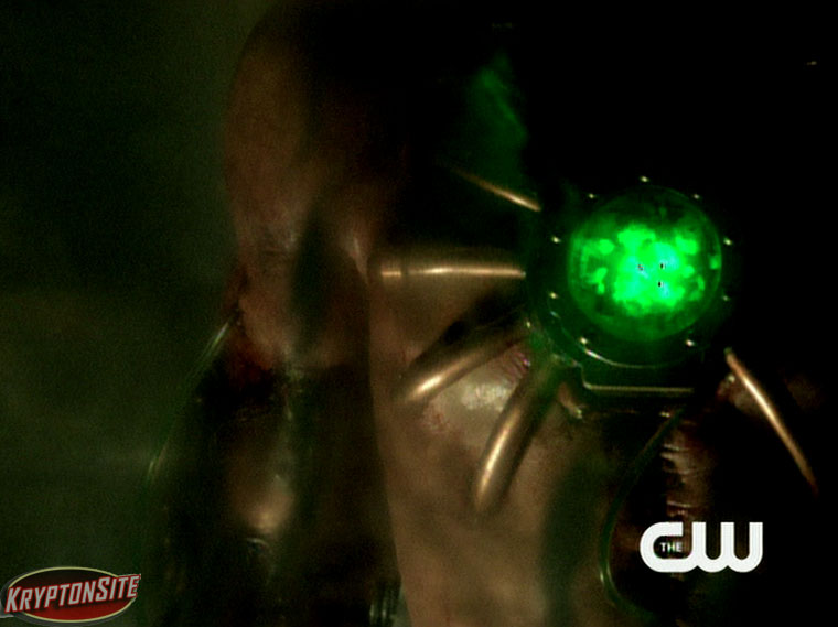 Smallville Metallo